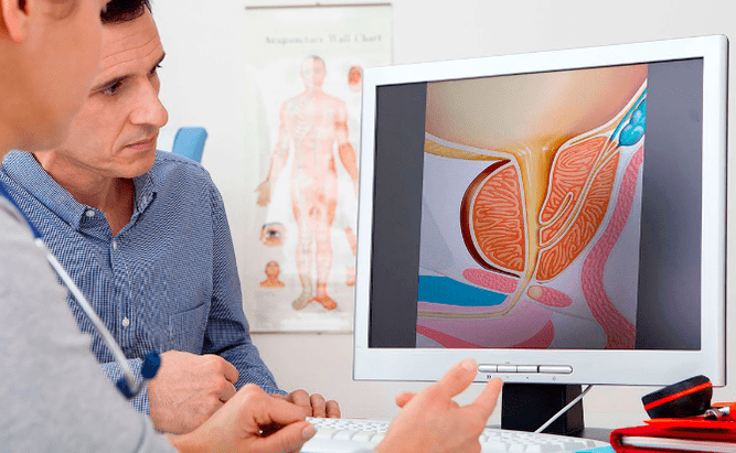Diagnostic de prostatite